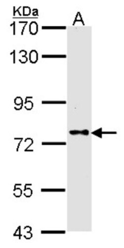 DPP8 Antibody, Novus Biologicals 0.1mg; Unlabeled:Anticuerpos