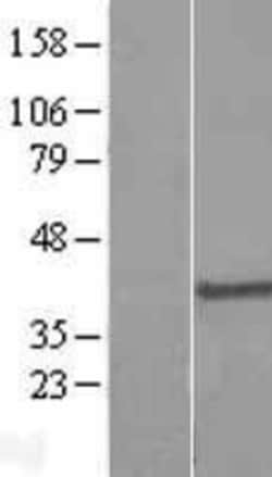 Novus Biologicals&trade;&nbsp;DPPA4 Overexpression Lysate