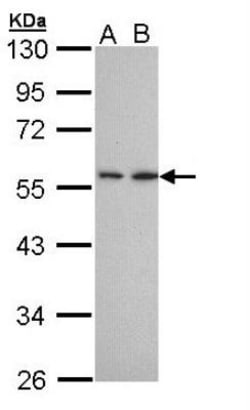 DPPII/QPP/DPP7 Antibody, Novus Biologicals 100 &mu;L | Buy Online | Novus Biologicals | Fisher Scientific