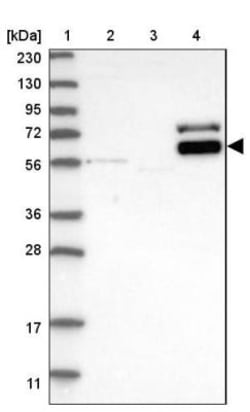 DPPII/QPP/DPP7 Antibody, Novus Biologicals 0.1mL; Unlabeled:Antibodies,