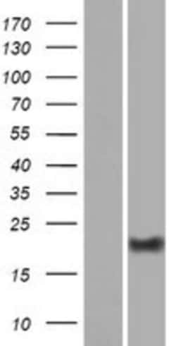 Novus Biologicals&trade;&nbsp;DPRX Overexpression Lysate