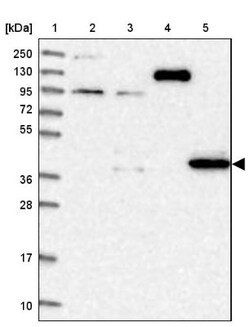 DPS Antibody, Novus Biologicals 25 &mu;L; Unlabeled:Antibodies, Polyclonal