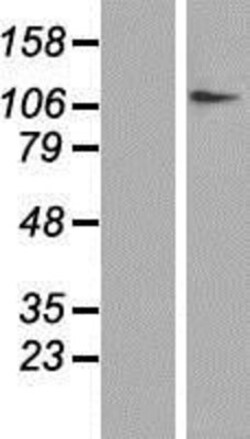 Novus Biologicals&trade;&nbsp;DPYD Overexpression Lysate