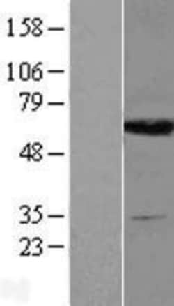 Novus Biologicals&trade;&nbsp;DPYS Overexpression Lysate
