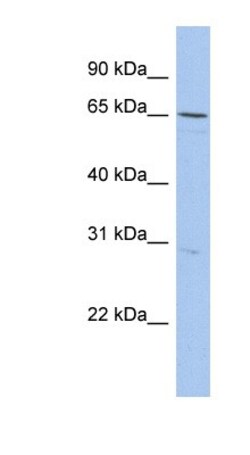 DQX1 Antibody, Novus Biologicals 100&mu;L; Unlabeled:Antibodies, Polyclonal