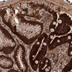 DQX1 Antibody, Novus Biologicals 0.1mL; Unlabeled:Antibodies, Polyclonal