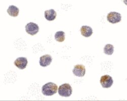 DRAK2 Antibody, Novus Biologicals 0.1mg; Unlabeled:Antibodies, Polyclonal