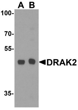 DRAK2 Antibody, Novus Biologicals 0.1mg; Unlabeled:Antibodies, Polyclonal