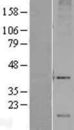 Novus Biologicals&trade;&nbsp;DRAM Overexpression Lysate