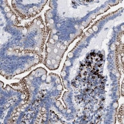 DRAM2 Antibody, Novus Biologicals:Antikroppar:Primära antikroppar