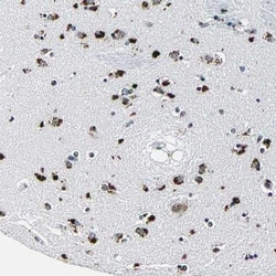 DRB1 Antibody, Novus Biologicals:Antibodies:Primary Antibodies