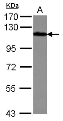 Drebrin 1 Antibody, Novus Biologicals 0.1 mL | Buy Online | Novus Biologicals | Fisher Scientific