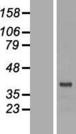 Novus Biologicals&trade;&nbsp;DRG2 Overexpression Lysate