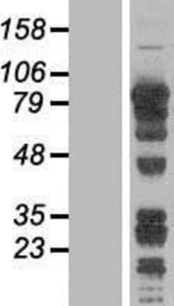 Novus Biologicals&trade;&nbsp;DRIL1 Overexpression Lysate