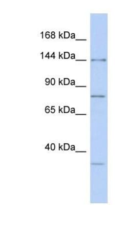 Drosha Antibody, Novus Biologicals 100 &mu;L | Buy Online | Novus Biologicals | Fisher Scientific
