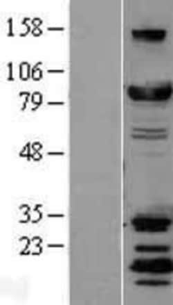 Novus Biologicals&trade;&nbsp;DRP1 Overexpression Lysate