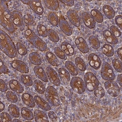 DRP1 Antibody, Novus Biologicals 25 &mu;L, Unlabeled:Antibodies, Polyclonal