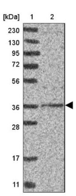 DSCC1 Antibody, Novus Biologicals 0.1 mL | Buy Online | Novus Biologicals | Fisher Scientific