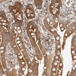 DSCC1 Antibody, Novus Biologicals 0.1 mL | Buy Online | Novus Biologicals | Fisher Scientific