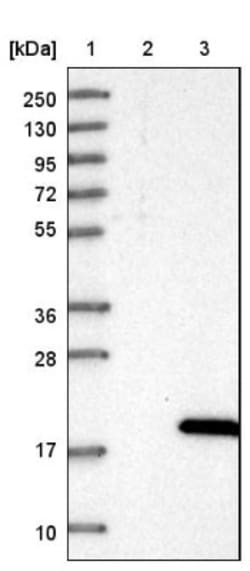 DSCR4 Antibody, Novus Biologicals 0.1mL; Unlabeled:Antibodies, Polyclonal