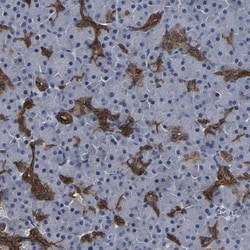 DSCR4 Antibody, Novus Biologicals 0.1mL; Unlabeled:Antibodies, Polyclonal