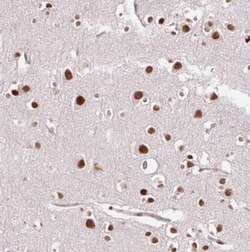 DSCR6 Antibody, Novus Biologicals 0.1mL; Unlabeled:Antibodies, Polyclonal