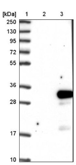 DTD1 Antibody, Novus Biologicals 0.1mL; Unlabeled:Antibodies, Polyclonal