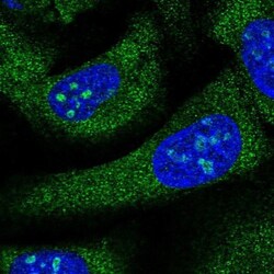 DTD1 Antibody, Novus Biologicals 0.1mL; Unlabeled:Antibodies, Polyclonal