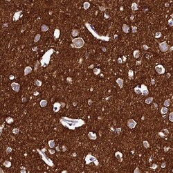 DTD1 Antibody, Novus Biologicals 0.1mL; Unlabeled:Antibodies, Polyclonal
