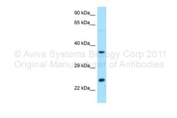 DTD1 Antibody, Novus Biologicals:Antibodies:Primary Antibodies