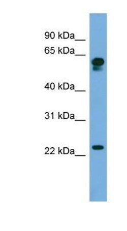 DTD2 Antibody, Novus Biologicals 100 &mu;L | Buy Online | Novus Biologicals | Fisher Scientific