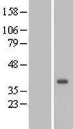 Novus Biologicals&trade;&nbsp;DTWD1 Overexpression Lysate