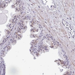 DTX4 Antibody, Novus Biologicals 0.1mL; Unlabeled:Antibodies, Polyclonal