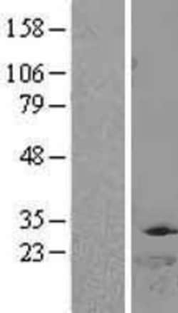 Novus Biologicals&trade;&nbsp;DTYMK Overexpression Lysate