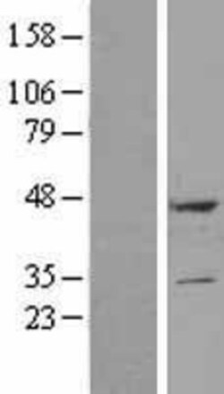 Novus Biologicals&trade;&nbsp;DULLARD Overexpression Lysate
