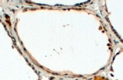 DUOX1 Antibody, Novus Biologicals 0.1mg; Unlabeled:Antibodies, Polyclonal