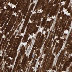 DUS1L Antibody, Novus Biologicals 25ul | Buy Online | Novus Biologicals | Fisher Scientific