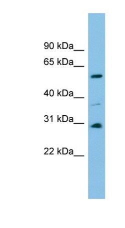 DUS1L Antibody, Novus Biologicals 100&mu;L; Unlabeled:Antibodies, Polyclonal