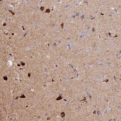 DUS3L Antibody, Novus Biologicals:Antibodies:Primary Antibodies