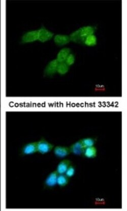 DUSP10 Antibody, Novus Biologicals 0.1mg; Unlabeled:Antibodies, Polyclonal