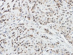 DUSP10 Antibody, Novus Biologicals 0.1mg; Unlabeled:Antibodies, Polyclonal