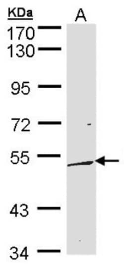 DUSP10 Antibody, Novus Biologicals 0.1mg; Unlabeled:Antibodies, Polyclonal