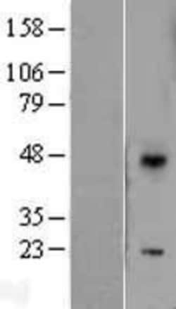 Novus Biologicals&trade;&nbsp;DUSP10 Overexpression Lysate