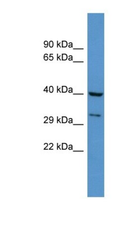 DUSP11 Antibody, Novus Biologicals 100&mu;L; Unlabeled:Antibodies, Polyclonal