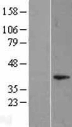 Novus Biologicals™ DUSP11 Overexpression Lysate