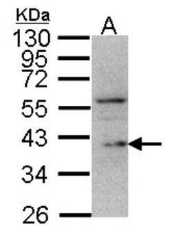 DUSP12 Antibody, Novus Biologicals 0.1mg; Unlabeled:Antibodies, Polyclonal