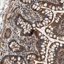 DUSP14 Antibody, Novus Biologicals 0.1mL; Unlabeled:Antibodies, Polyclonal