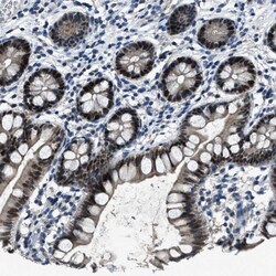 DUSP19 Antibody, Novus Biologicals:Antibodies:Primary Antibodies