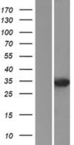 Novus Biologicals&trade;&nbsp;DUSP2 Overexpression Lysate