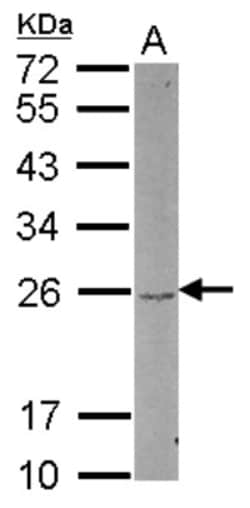 DUSP22 Antibody, Novus Biologicals 0.1mL; Unlabeled:Antibodies, Polyclonal